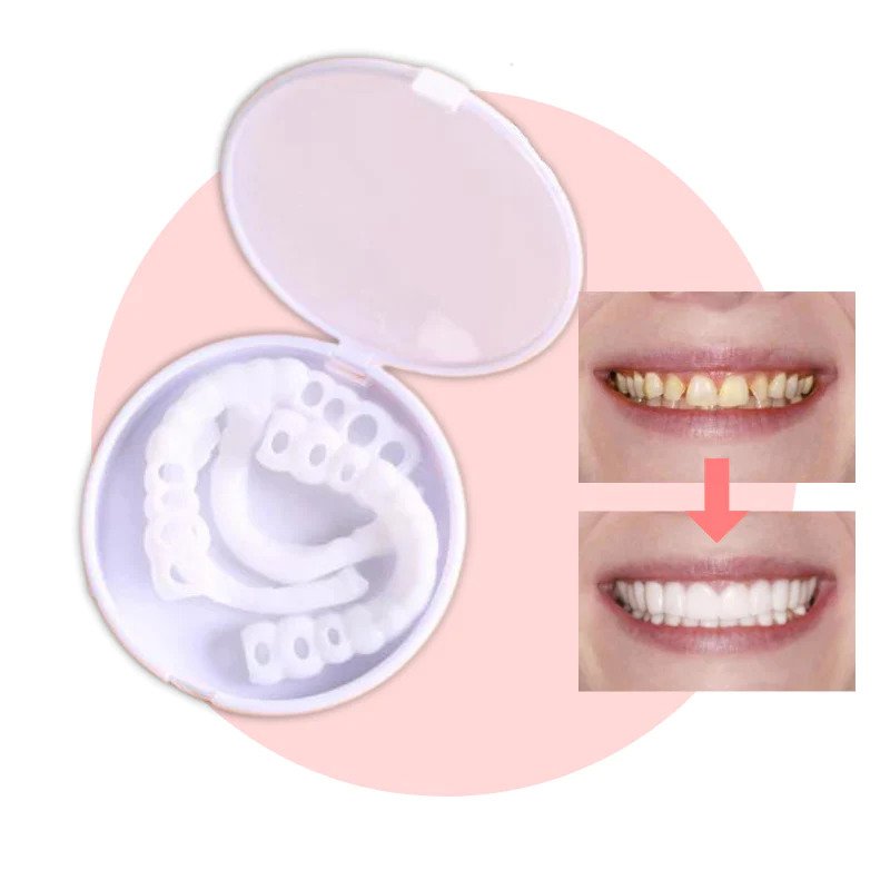 Facette Dentaire Instantanée pour Sourire Naturel - Foivo